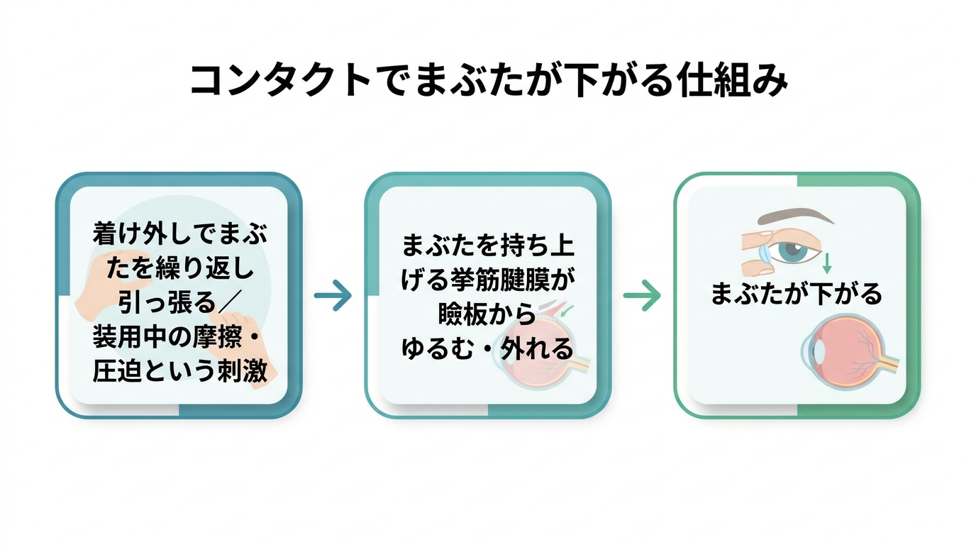 コンタクトレンズで眼瞼下垂になる?原因と対処法を解説