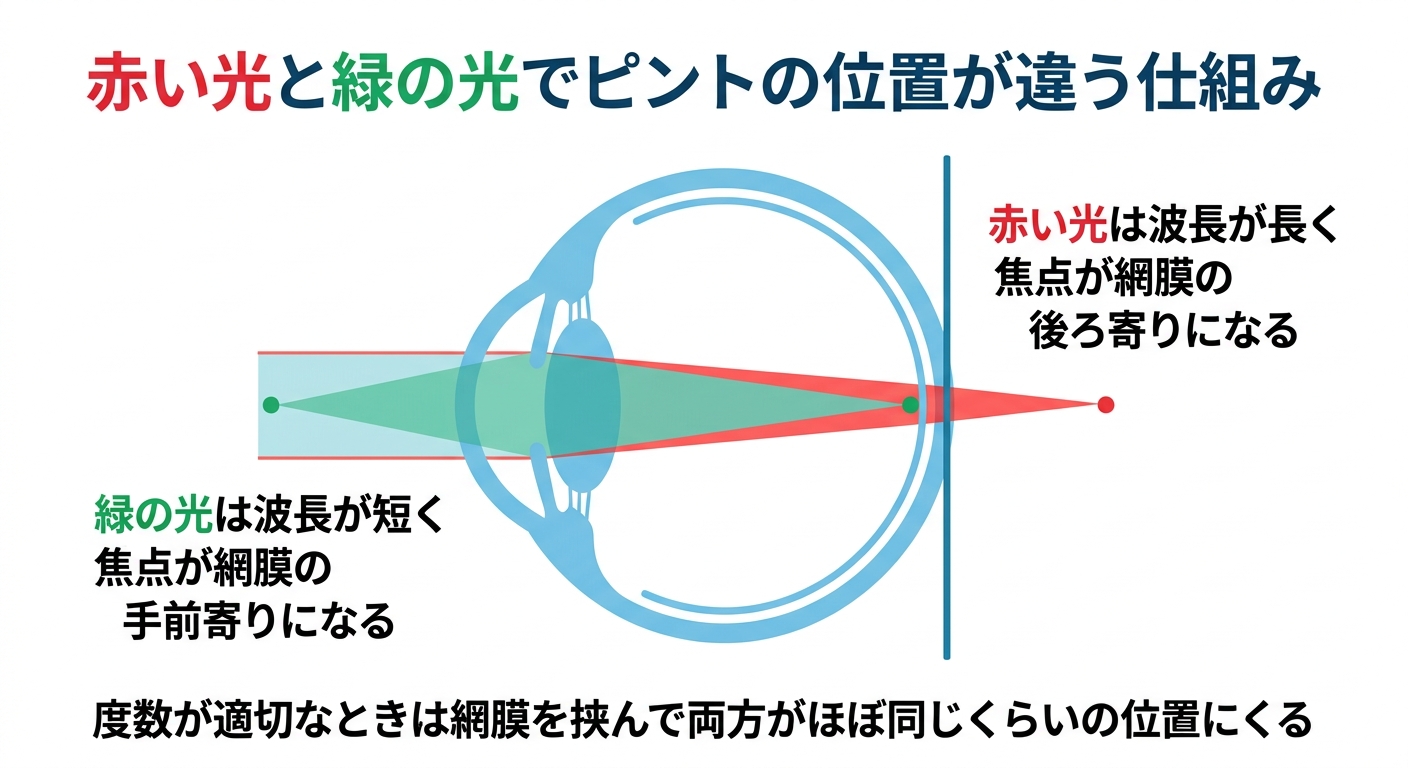眼科の「赤と緑どちらがよく見える?」検査の意味と答え方を解説